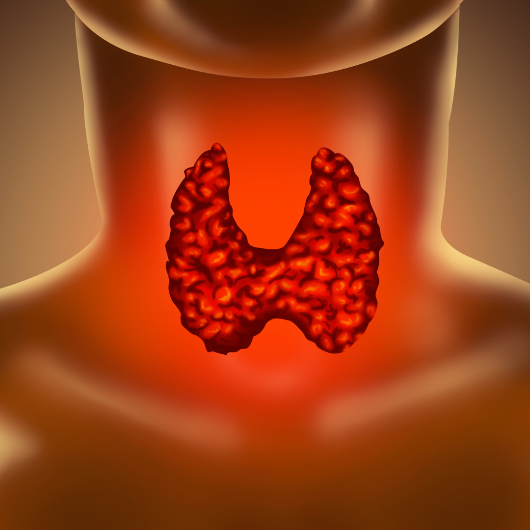 top-8-foods-to-prevent-thyroid-cancer-mlc